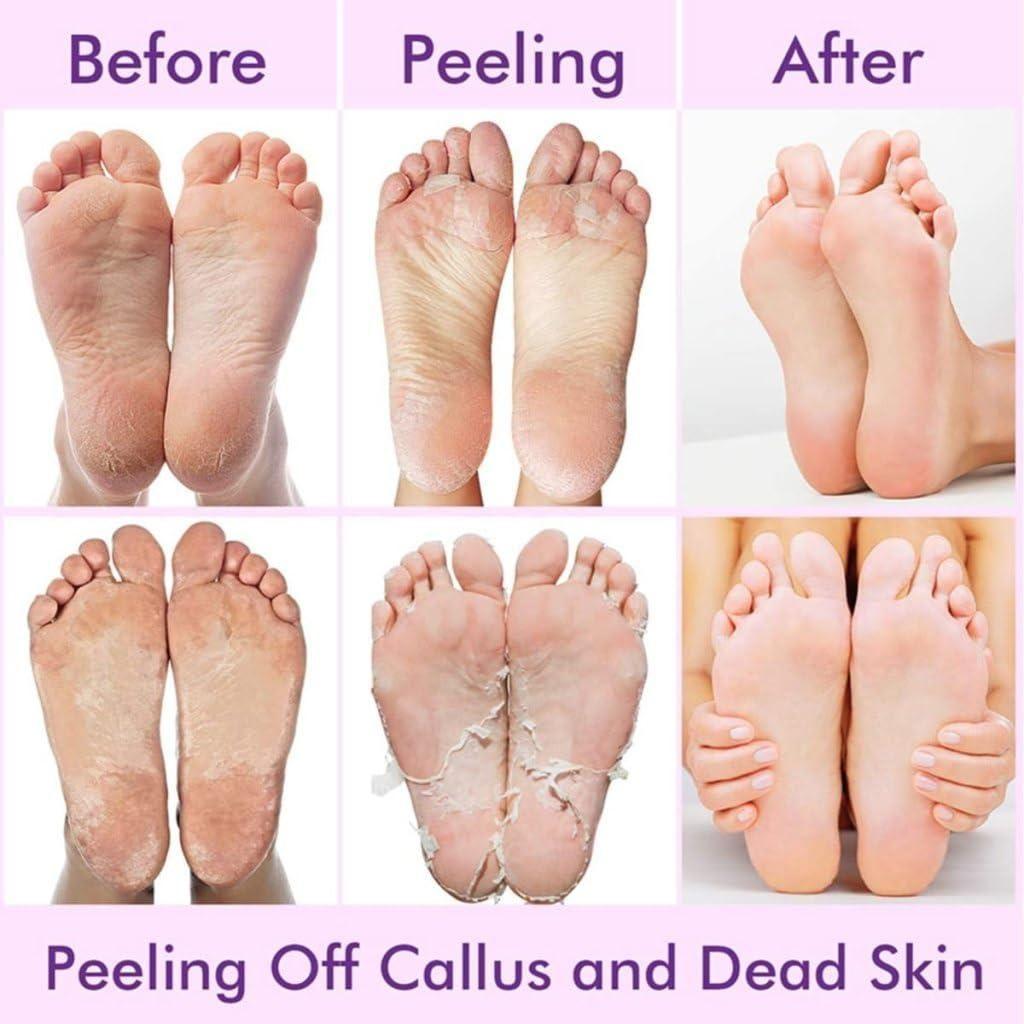 Foot Peel Masks for Women & Men | Exfoliating & Moisturizing For Foot & Hand Skin Repair | Dry Cracked Feet and Hand, Removes Dead Skin & Calluses, Hydrates & Smooths Cracked Heels