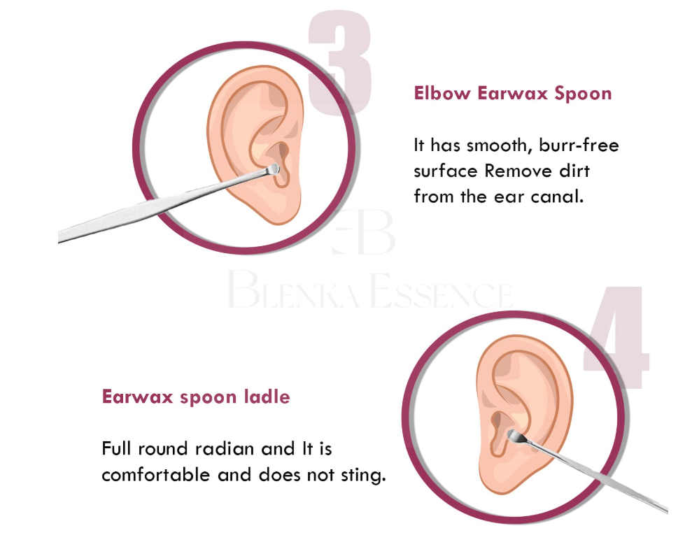 6 Pcs Ear Pick with a Storage Box Earwax Removal Kit  | Ear Cleansing Tool Set | Stainless Steel Spiral Ear Curette Ear Wax Remover Tool with Cleaning Brush